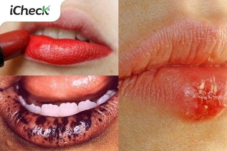 Tác hại của việc sử dụng son giả