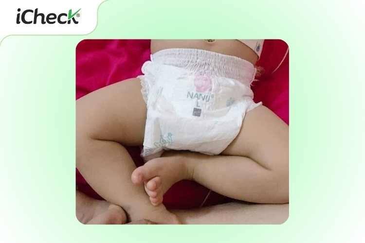 Bỉm Nanu thật có phần chun bụng rộng và co giãn tốt - tạo cảm giác thoải mái cho bé