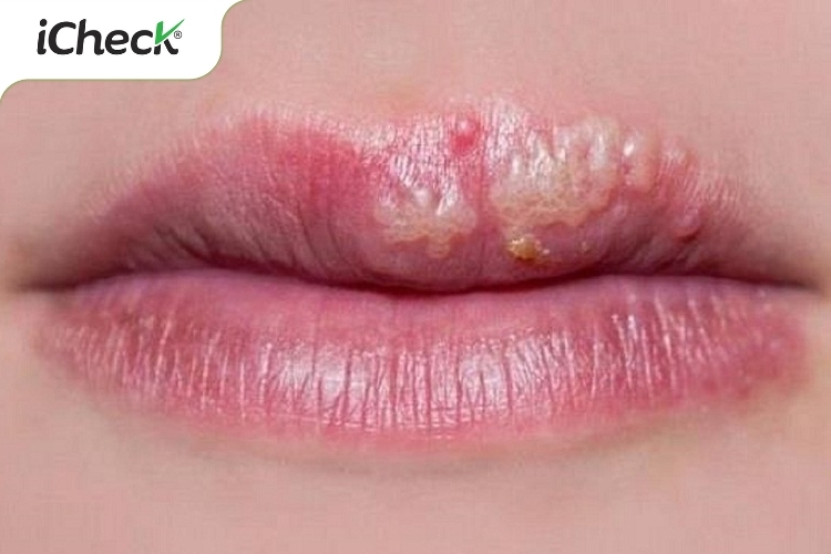 Tác hại từ sản phẩm Vaseline giả