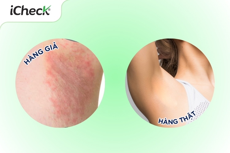 Hình ảnh minh họa khi dùng Etiaxil thật và giả